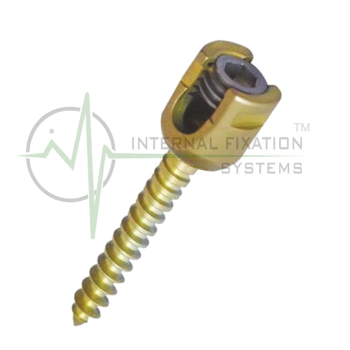 IFS-MONO-AXIAL-SCREW-3 IFS Mono Axial Screw Dia 7.5mm