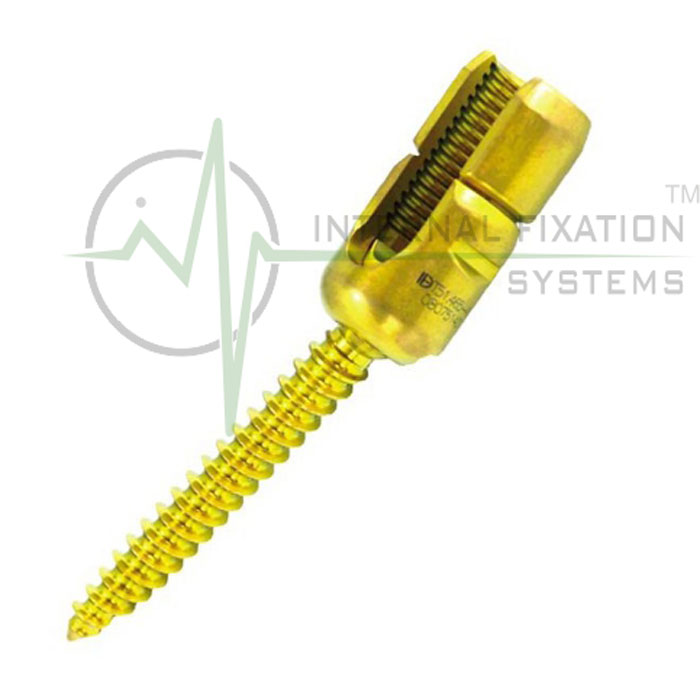 IFS-POLY-AXIAL-REDUCTION-SCREW-02 IFS Poly Axial Reduction Screw Dia 6.5mm