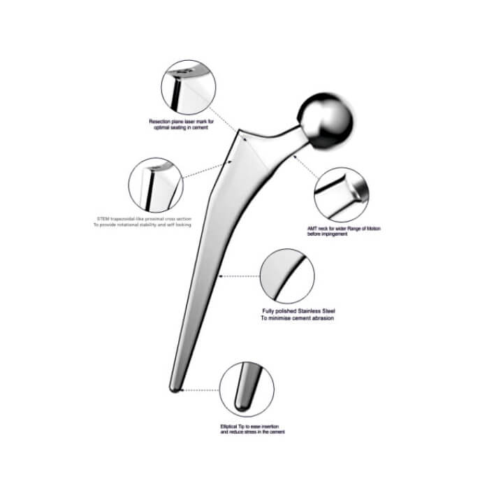 Genx-cementing-hip-replacement GenX Cementing Hip Replacement